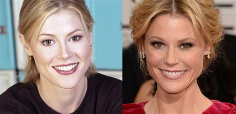 Julie Bowen Face Plastic Surgery