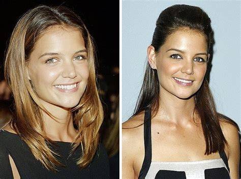 Katie Holmes Face Surgery