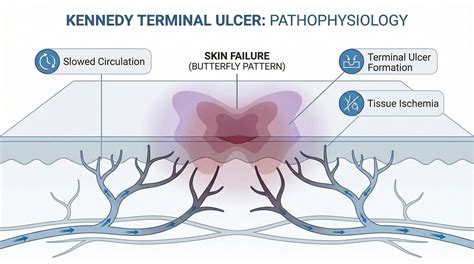 Kennedy Ulcer Pictures