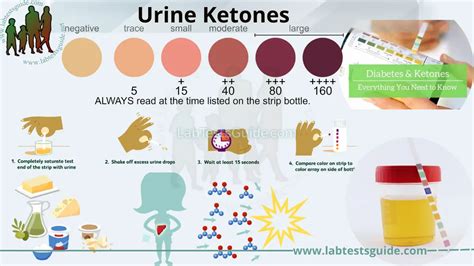 Ketones Urine High