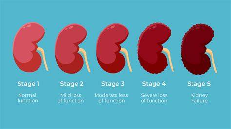 Kidney Disease Stage 4