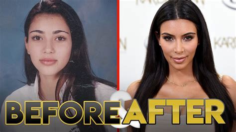 Kim Kardashian Face Before Plastic Surgery