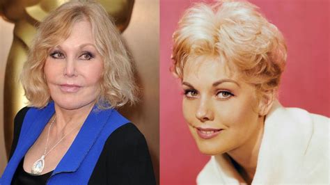 Kim Novak Face Surgery