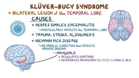 Kluver And Bucy Syndrome