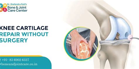 Knee Cartilage Surgery