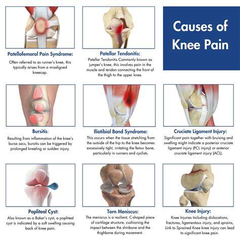 Knee Pain Causes