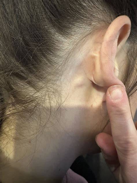 Knot Behind My Ear