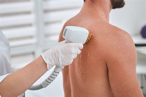 Laser Hair Removal Back