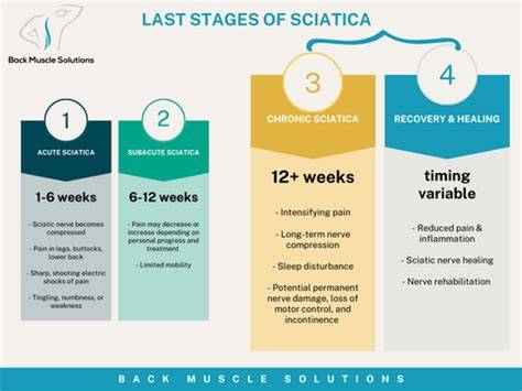 Last Stages Of Sciatica