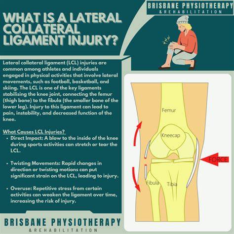 Lateral Collateral Ligament Injury Symptoms