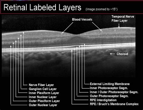 Layers Of Retina Oct