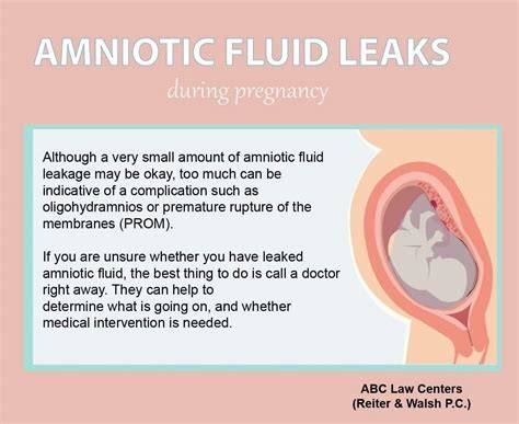 Leaking Amniotic Fluid