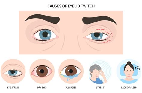 Left Eye Muscle Twitch