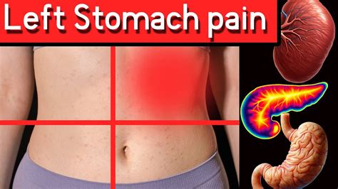 Left Flank Pain