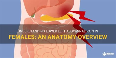 Left Lower Abdomen Pain Female