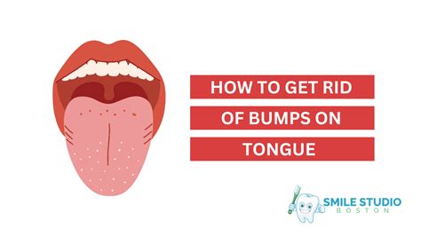 Lie Bump On The Tongue