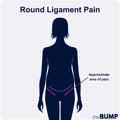 Ligament Pain Pregnancy