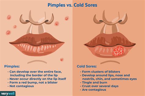 Lip Pimples Vs Cold Sores