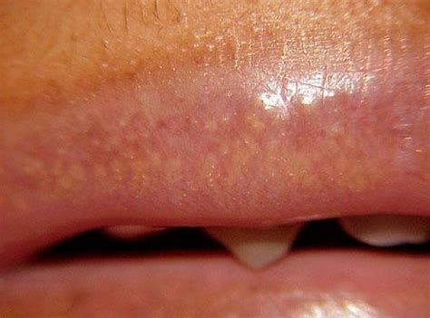 Lips With White Dots
