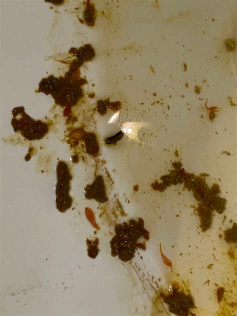 Liver Flukes In Stool Pictures