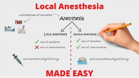Local Anesthetic Vs General