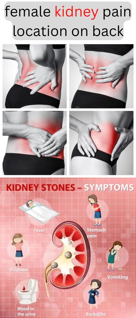 Location Of Kidney Pain