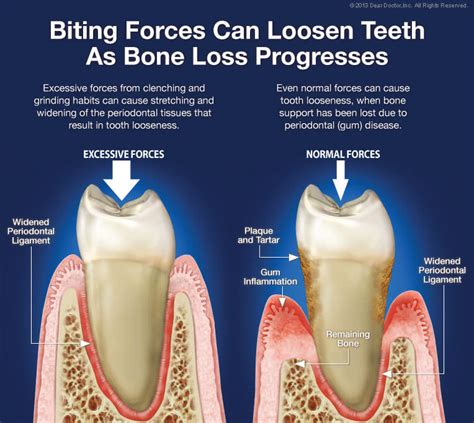 Loose Adult Tooth