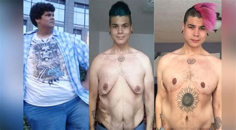 Loose Skin Removal