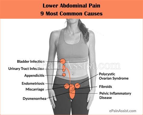 Lower Abdomen Pain And Back