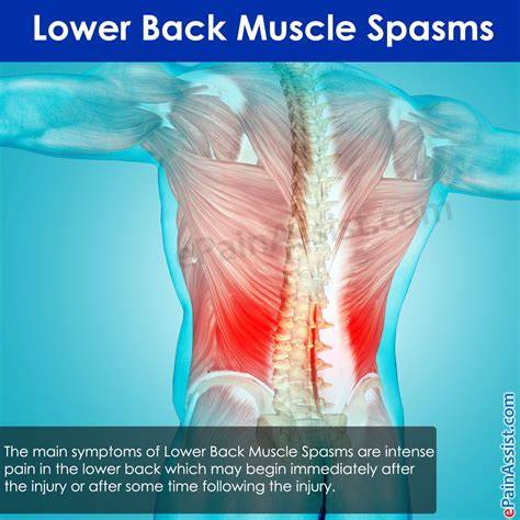 Lower Back Spasm