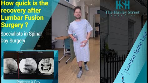 Lumbar Fusion Recovery