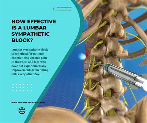 Lumbar Sympathetic Block