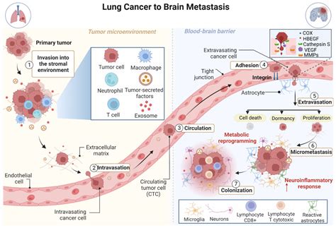 Lung Cancer Metastasis