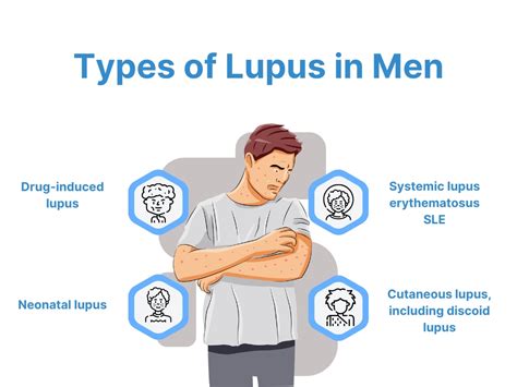 Lupus In Men