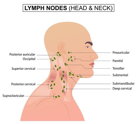 Lymph Node Localization