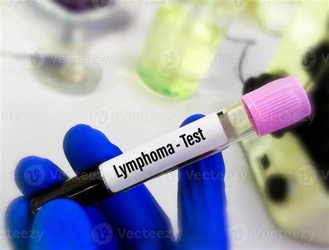 Lymphoma Blood Test