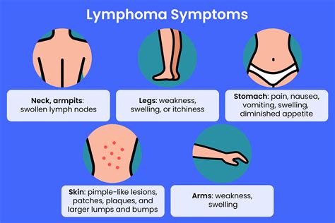 Lymphoma Symptoms Female