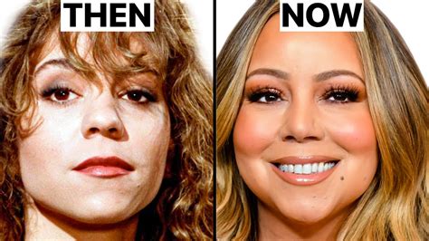 Mariah Carey Face Surgery