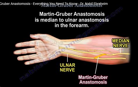 Martin Gruber Anastomosis
