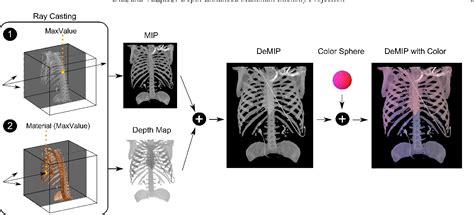 Maximum Intensity Projection