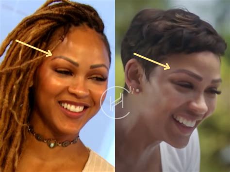 Meagan Good Face Surgery