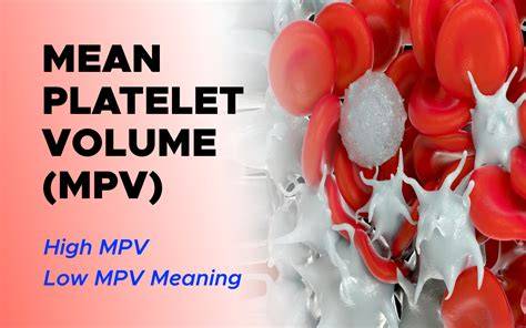 Mean Platelet Volume High