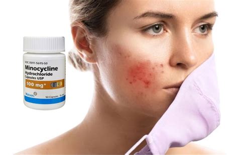 Minocycline Ruined My Life