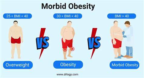 Morbid Obesity Definition