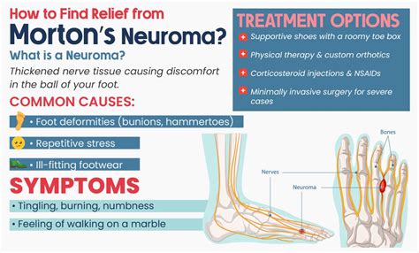 Mortons Neuroma Treatment