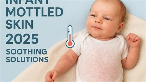 Mottled Skin Infant