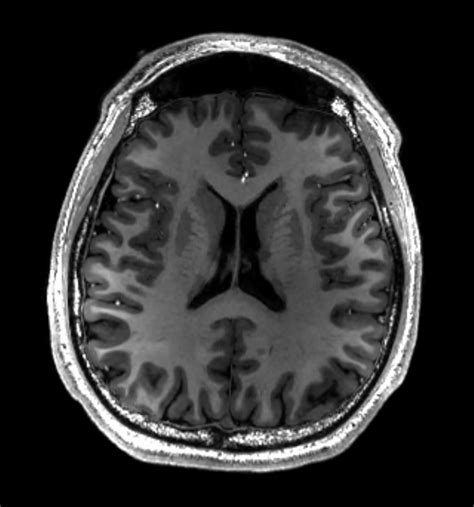 Mri Discovered By Year