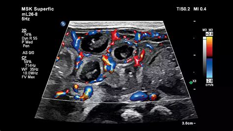 Msk Ultrasound
