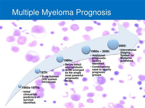 Multiple Myeloma Prognosis By Age