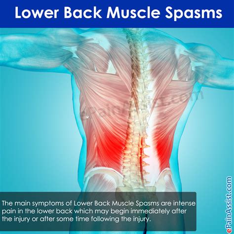 Muscle Spasm In Back